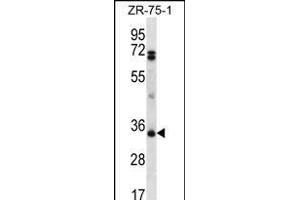 PDCD1LG2 Antibody (N-term) (ABIN656243 and ABIN2845559) western blot analysis in ZR-75-1 cell line lysates (35 μg/lane). (PDCD1LG2 antibody  (N-Term))