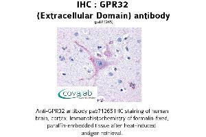 Image no. 1 for anti-G Protein-Coupled Receptor 32 (GPR32) (2nd Extracellular Domain) antibody (ABIN1735058) (GPR32 antibody  (2nd Extracellular Domain))