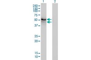 Western Blot analysis of HERPUD1 expression in transfected 293T cell line by HERPUD1 monoclonal antibody (M01), clone 3E10. (HERPUD1 antibody  (AA 1-391))