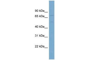 WB Suggested Anti-SLC7A1  Antibody Titration: 0. (SLC7A1 antibody  (N-Term))