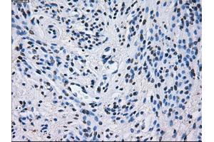 Immunohistochemical staining of paraffin-embedded liver tissue using anti-PSMA7mouse monoclonal antibody.