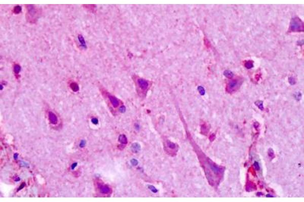 HTR1F antibody  (C-Term)