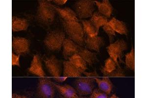 Immunofluorescence analysis of C6 cells using SCRN3 Polyclonal Antibody at dilution of 1:100. (Secernin 3 antibody)