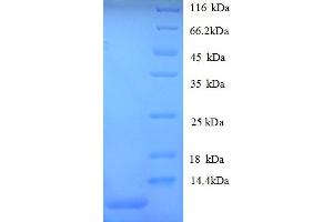 SDS-PAGE (SDS) image for GRO alpha Protein (GRO-A) (AA 29-96) protein (His tag) (ABIN5712662)