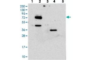 Western blot analysis of Lane 1: RT-4, Lane 2: U-251 MG, Lane 3: Human Plasma, Lane 4: Liver, Lane 5: Tonsil with EYA4 polyclonal antibody .