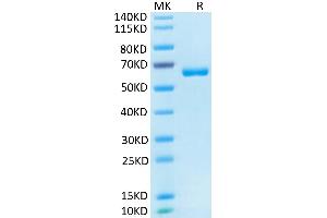Human CD2 on Tris-Bis PAGE under reduced condition. (CD2 Protein (CD2) (AA 25-209) (Fc Tag))