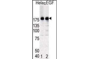 Western blot analysis of EGFR (arrow) in Hela cell lysates, either induced (Lane 1) or noninduced with EGF (Lane 2). (EGFR antibody  (pTyr1092))