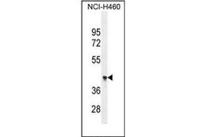 Western blot analysis of OXD4-like 1 Antibody (N-term) in NCI-H460 cell line lysates (35ug/lane). (FOXD4L1 antibody  (N-Term))