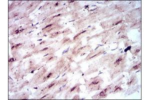 Immunohistochemistry (IHC) image for anti-Solute Carrier Family 2 (Facilitated Glucose Transporter), Member 4 (SLC2A4) (AA 224-353) antibody (ABIN1846354) (GLUT4 antibody  (AA 224-353))