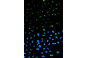 Immunofluorescence analysis of MCF7 cell using PSAP antibody.