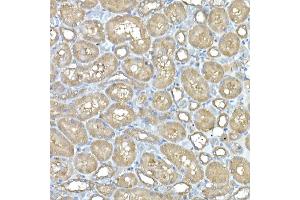 Immunohistochemistry of paraffin-embedded rat kidney using IL11RA Rabbit mAb (ABIN7267984) at dilution of 1:150 (40x lens). (IL11RA antibody)