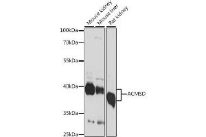 Western blot analysis of extracts of various cell lines, using ACMSD antibody (ABIN7265570) at 1:1000 dilution. (ACMSD antibody  (AA 1-336))