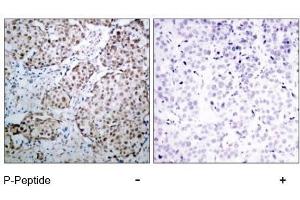Image no. 3 for anti-Tumor Protein P53 (TP53) (pSer315) antibody (ABIN196788) (p53 antibody  (pSer315))