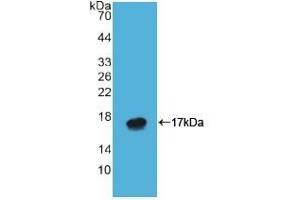 Detection of Recombinant ATP4a, Human using Polyclonal Antibody to ATPase, H+/K+ Exchanging Alpha Polypeptide (ATP4a) (ATP4A antibody  (AA 798-896))