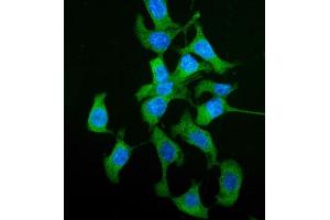 IF analysis of HGD using anti-HGD antibody (ABIN5693116). (HGD antibody  (AA 374-445))