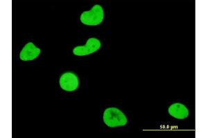 Immunofluorescence (IF) image for anti-serum/glucocorticoid Regulated Kinase 1 (SGK1) (AA 1-90) antibody (ABIN562850)