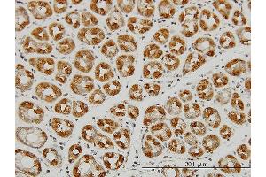 Immunostaining (ISt) image for anti-Argonaute 2 (AGO2) (AA 1-377) antibody (ABIN565346)