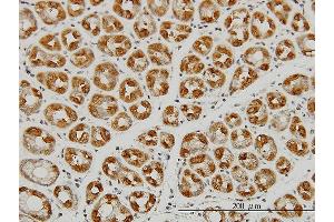 Immunoperoxidase of monoclonal antibody to EIF2C2 on formalin-fixed paraffin-embedded human stomach. (AGO2 antibody  (AA 1-377))