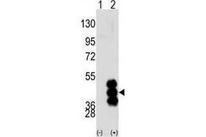 Western blot analysis of PHKG2 (arrow) using PHKG2 Antibody (N-term) . (PHKG2 antibody  (N-Term))