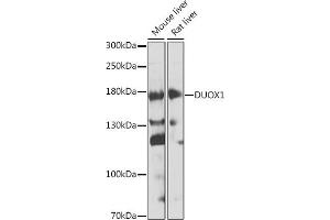 Western blot analysis of extracts of various cell lines, using DUOX1 antibody (ABIN6127816, ABIN6139857, ABIN6139858 and ABIN6224687) at 1:1000 dilution. (DUOX1 antibody  (AA 1312-1551))