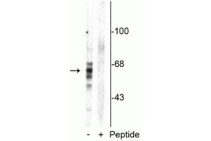 Western blot of rat brain homogenate showing specific immunolabeling of the ~59 kDa, ~65 kDa, ~68 kDa Tau isoforms phosphorylated at Ser416 in the first lane (-).