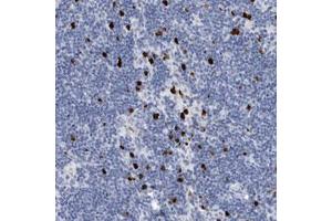 Immunohistochemical staining (Formalin-fixed paraffin-embedded sections) of human lymph node with S100A8 polyclonal antibody  shows strong cytoplasmic and nuclear positivity in a subset of cells outside reaction centra. (S100A8 antibody)