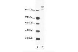 Image no. 1 for anti-HKR1, GLI-Kruppel Zinc Finger Family Member (HKR1) (AA 191-240) antibody (ABIN202856) (HKR1 antibody  (AA 191-240))