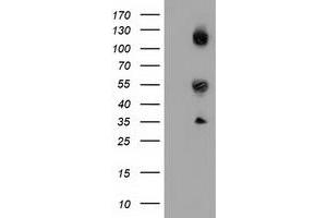 HEK293T cells were transfected with the pCMV6-ENTRY control (Left lane) or pCMV6-ENTRY CALCOCO2 (Right lane) cDNA for 48 hrs and lysed. (CALCOCO2 antibody)