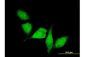 Immunofluorescence of purified MaxPab antibody to HDAC6 on HeLa cell. (HDAC6 antibody  (AA 1-1215))