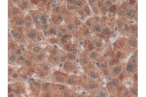 Immunohistochemistry (IHC) image for anti-Enhancer of Zeste Homolog 2 (EZH2) (AA 51-285) antibody (ABIN7436762)