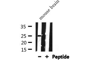 Western blot analysis of APOA1 expression in Mouse brain lysate (APOA1 antibody  (N-Term))