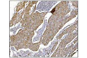 IHC analysis of NDEL1 using anti-NDEL1 antibody (ABIN7602511).