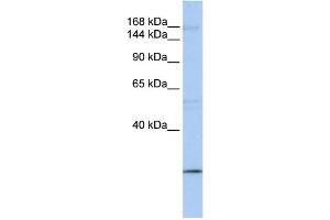 WB Suggested Anti-UBR2 Antibody Titration:  0. (UBR2 antibody  (C-Term))