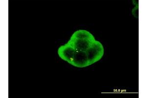 Immunofluorescence of monoclonal antibody to C1orf19 on MCF-7 cell. (TSEN15 antibody  (AA 72-170))