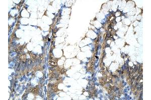 PPIA antibody was used for immunohistochemistry at a concentration of 4-8 ug/ml to stain Epithelial cells of intestinal villus (arrows) in Human Intestine. (PPIA antibody)