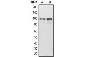 Western blot analysis of DDX54 expression in HeLa (A), Jurkat (B) whole cell lysates. (DDX54 antibody  (Center))