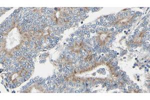 ABIN6275145 at 1/100 staining Human prostate tissue by IHC-P. (GCP6 antibody  (Internal Region))