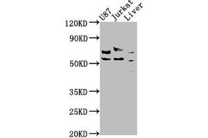 Western Blot Positive WB detected in: U87 whole cell lysate, Jurkat whole cell lysate, Rat liver tissue All lanes: CDK5RAP3 antibody at 1:1000 Secondary Goat polyclonal to rabbit IgG at 1/50000 dilution Predicted band size: 57, 47, 32, 60 kDa Observed band size: 57 kDa (CDK5RAP3 antibody  (Regulatory Subunit))