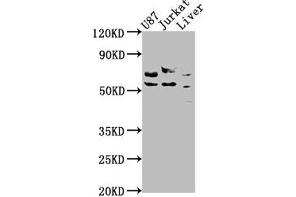 CDK5RAP3 抗体  (Regulatory Subunit)