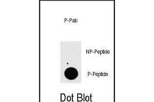 Dot blot analysis of anti-P3K7IP1-p Phospho-specific Pab (ABIN389806 and ABIN2839699) on nitrocellulose membrane. (TAB1 antibody  (pSer423))
