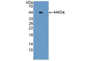 Detection of Recombinant Glutamine Synthetase, Human using Polyclonal Antibody to Glutamine synthetase (GS) (GLN1 antibody  (AA 1-373))