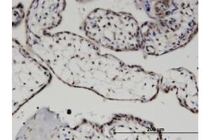 Image no. 1 for anti-MYST Histone Acetyltransferase (Monocytic Leukemia) 3 (MYST3) (AA 81-180) antibody (ABIN599471) (MYST3 antibody  (AA 81-180))