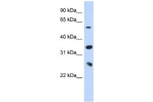 UBE2K antibody used at 1 ug/ml to detect target protein. (UBE2K antibody)