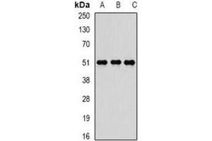 Western blot analysis of Reptin 52 expression in K562 (A), SW480 (B), MCF7 (C) whole cell lysates. (RUVBL2 antibody)