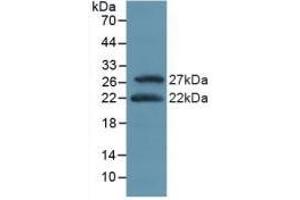 Detection of Recombinant ATF4, Mouse using Polyclonal Antibody to Activating Transcription Factor 4 (ATF4) (ATF4 antibody  (AA 126-291))