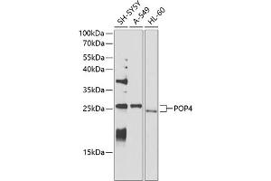Western blot analysis of extracts of various cell lines, using POP4 antibody (ABIN6128482, ABIN6145964, ABIN6145966 and ABIN6220640) at 1:1000 dilution.