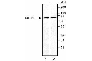 Western blot analysis of MLH1. (MLH1 antibody)