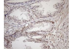 Immunohistochemistry (IHC) image for anti-Achalasia, Adrenocortical Insufficiency, Alacrimia (AAAS) (AA 322-546) antibody (ABIN2715861) (Adracalin antibody  (AA 322-546))