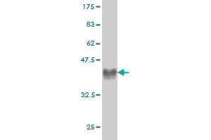 Western Blot detection against Immunogen (37. (CRIM1 antibody  (AA 36-145))