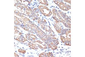 Immunohistochemistry (IHC) image for anti-Keratin 18 (KRT18) (AA 127-430) antibody (ABIN7268098)